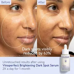 *PREORDEN* Caudalie Vinoperfect Brightening Dark Spot Serum Vitamin C Alternative en internet