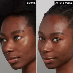 *PREORDEN* The INKEY Tranexamic Acid Hyperpigmentation Treatment - Maw Maw Beauty
