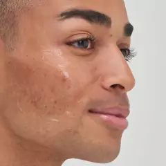 *PREORDEN* The INKEY Tranexamic Acid Hyperpigmentation Treatment - comprar en línea