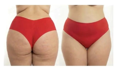 Calcinha de microfibra, duplo fio- HOT PANT (Tamanho G1, G2 e G3) - Íntima IC Plus