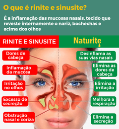 Naturite Spray Nasal - Tratamento 100% Natural para Rinite e Sinusite na internet