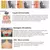 Imagem explicativa sobre as funções do aparelho de Lipocavitação Ultrassônica, incluindo infravermelho, massagem ultrassônica e EMS - micro corrente.