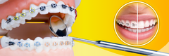 Banner da categoria Ortodontia