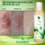 Gel De Aloe Vera Hidratação Intensa Pos Depilação Dokmos na internet