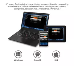 Imagen de Ultrasonido Importado a Color inalámbrico Wifi, Sonda 3 en 1, 3,5 MHz/5MHz, convexo/7,5 MHz, sonda lineal, compatible con iOS, Android y Windows