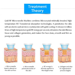 Microneedling Maquina Radiofrecuencia De Oro Cristal Honkong - comprar en línea