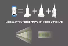 Ultrasonido Importado a Color inalámbrico Wifi, Sonda 3 en 1, 3,5 MHz/5MHz, convexo/7,5 MHz, sonda lineal, compatible con iOS, Android y Windows - comprar en línea