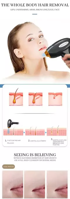 Laser Diodo Picosegundo Elimina vello y Tatuaje con Laser De Carbono Permanente 2 En 1