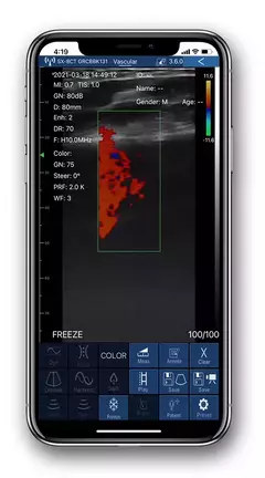 Imagen de Ultrasonido Digital inalámbrico, máquina de ultrasonido portátil, sonda Viatom 3 en 1