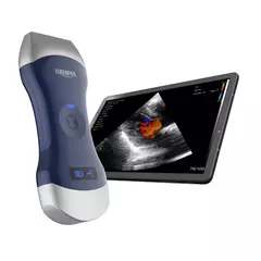 Ultrasonido Digital inalámbrico, máquina de ultrasonido portátil, sonda Viatom 3 en 1