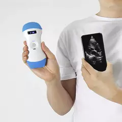 Ultrasonido Importado a Color inalámbrico Wifi, Sonda 3 en 1, 3,5 MHz/5MHz, convexo/7,5 MHz, sonda lineal, compatible con iOS, Android y Windows - INSULAB COMERCIALIZADORA  | Tienda Oficial Venta de Materiales para Laboratorio 