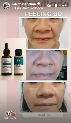 COMBO PEELING + KIT LIMPEZA DE PELE + FATOR DE CRESCIMENTO