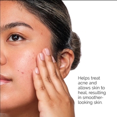The Ordinary The Acne Set en internet