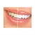 Comparação de dentes antes e depois do clareamento dental, mostrando dentes amarelos à esquerda e dentes brancos e brilhantes à direita.