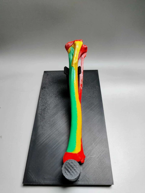 Modelo 3d - Corredores Seguros CAO - Tibia e Fibula