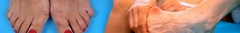 Banner da categoria Corretor protetor de joanetes