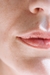 CUTIS RADIANTE