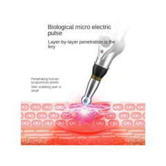 Lápiz De Acupuntura Electroestimulador - Es Necesario
