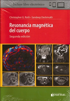 Resonancia magnética del cuerpo