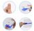 Dispositivo Profesional de Tratamiento Láser para Hongos de Uñas en Casa - Cure-Ex - tienda en línea