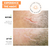 Strataderm® - Gel de Terapia para Cicatrices (10 g) - Para Cicatrices Viejas y Nuevas - Styla