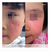 Imagen de Rejuvaskin® RejuvaSil Silicone Scar Gel - Mejora la Apariencia de las Cicatrices - Recomendado por Médicos - 15 mL