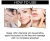 WIZOLA® Crema de Eliminación de Cicatrices de Acné y Pigmentación Facial - Pack de 2 - Styla