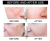 WIZOLA® Crema de Eliminación de Cicatrices de Acné y Pigmentación Facial - Pack de 2 - tienda en línea