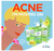 St Ives® Tratamiento de Puntos de Control de Acné de Árbol de Té - 0.75 fl. Onz - comprar en línea