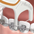 Plackers® Orthopick Flossers, 36 Unidades (Paquete de 3)