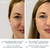 Imagen de FOREO® BEAR mini Dispositivo de Lifting Facial con Microcorriente Dirigida - Ejercitador de Mandíbula y Rostro - Lifting Facial Inmediato No Invasivo - Lavanda