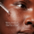 Imagen de SkinCeuticals® Blemish + Age Defense 30ml