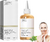 Glycolic Acid 7% 100 ml THE ORDINARY®