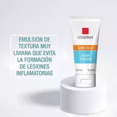 ACNEX DEPURE CONTROL TREATMENT - tienda online
