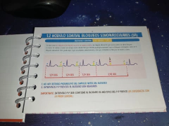 Imagen de EKG Patológico