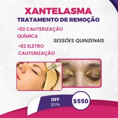 TRATAMENTO DE XANTELASMA / ELETROCAUTÉRIZAÇÃO E CAUTERIZAÇÃO QUÍMICA