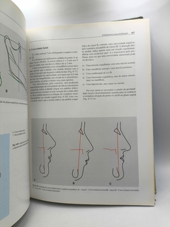 Ortodontia e Cirurgia Ortognática - Diagnóstico e Planejamento - Autor: Jorge Gregoret (1999) [usado] - Sebo Paraibuna