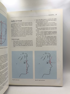 Ortodontia e Cirurgia Ortognática - Diagnóstico e Planejamento - Autor: Jorge Gregoret (1999) [usado] - loja online