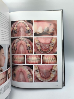 Ortodontia Lingual - o Segredo por trás do Sorriso - Autor: Henrique Bacci (2011) [usado] - Sebo Paraibuna