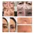 Ponteiras para Eletrocautério/Jato de Plasma - Estética Prime Store