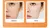 Kit completo de Vitamina C