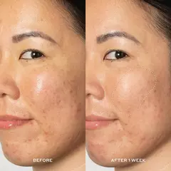 Glow2OH 7% AHA Exfoliating Dark Spot Toner en internet