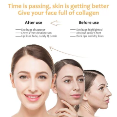 Masajeador Rejuvenedor Facial - Mandarina Store