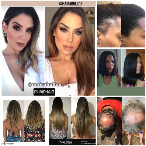 Antes e depois - comprar online