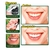 Imagen de Blanqueador Dental Carbón Coco Dientes Blanco Polvo Activado