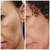 Imagem do Kit Controle | Skincare Terapêutico Desinflame