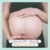 Consulta Pre Natal Parto y Lactancia