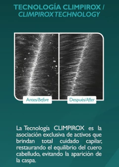 Kareol Anticaspa Serum Y Shampoo · Protege Cuero Cabelludo en internet