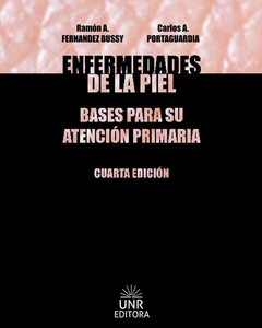 ENFERMEDADES DE LA PIEL
