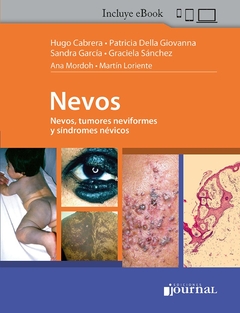 NEVOS